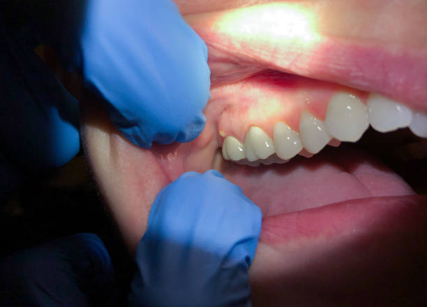 Best Pediatric Emergency Dentist in Hayfield, MN